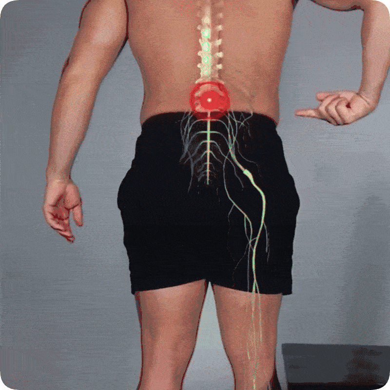 Kregoslup przed i po zastosowaniu poduszki